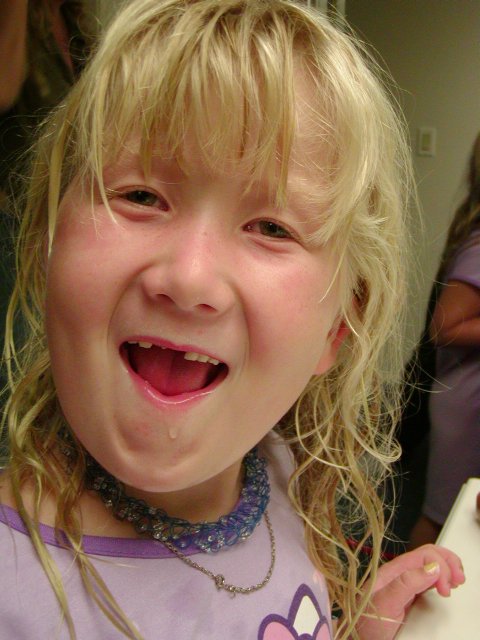 Three teeth gone!